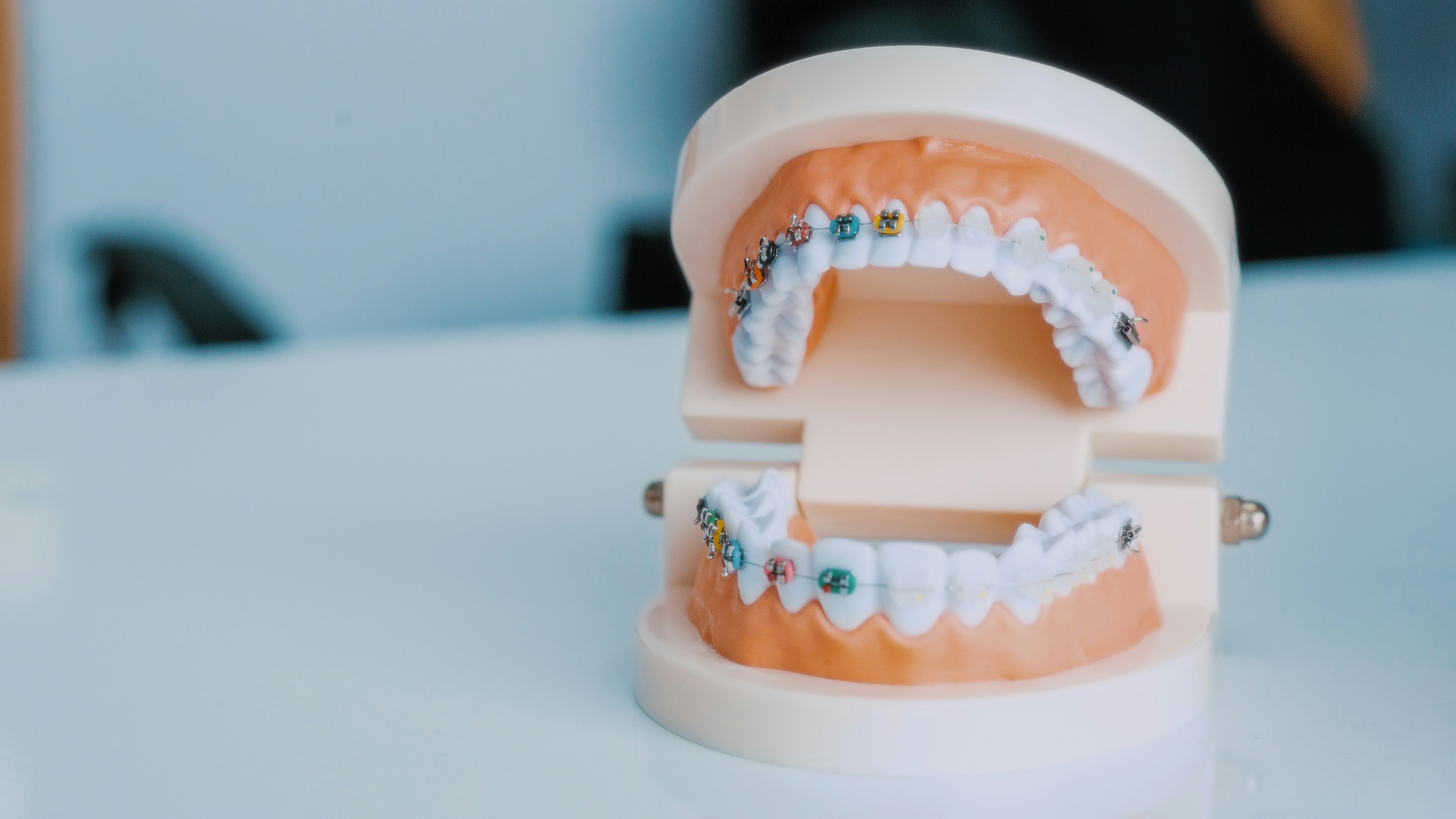 Orthodontic Treatment