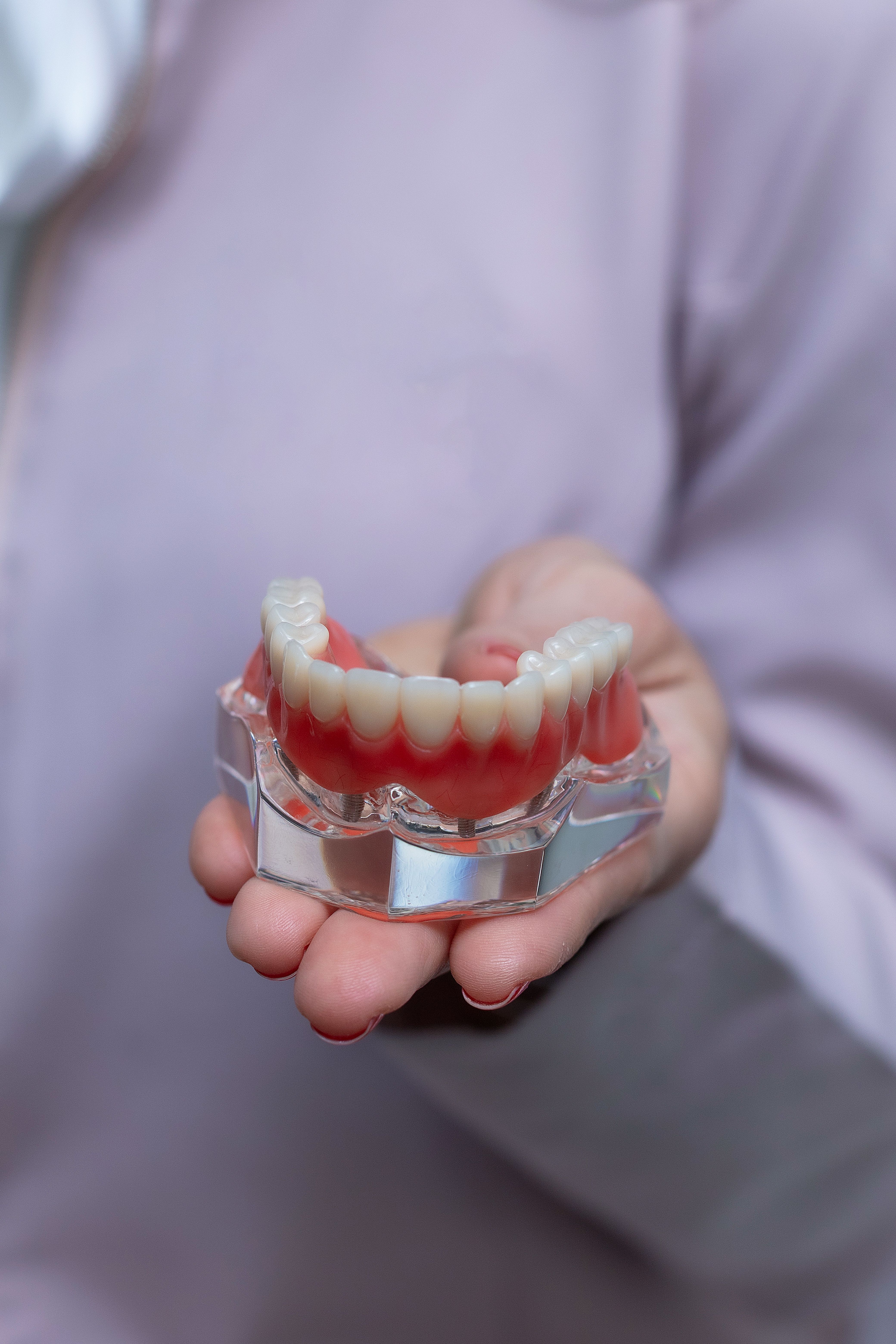 Teeth Implant